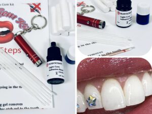 Tooth Gem Kits – Rubyscraft